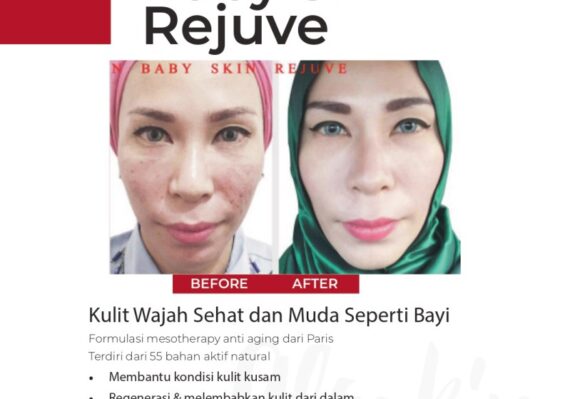 klinik kecantikan gloskin aesthetic amp skin care bekasi_da8368616.jpg