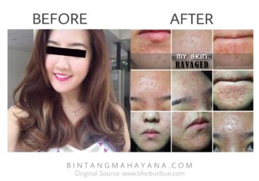 perawatan badan di klinik kecantikan_25a46ca25.jpg