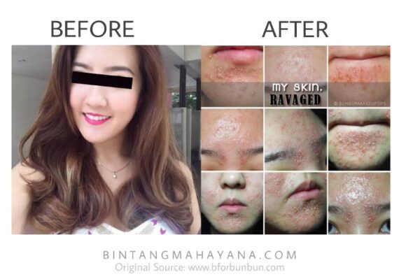 perawatan badan di klinik kecantikan_25a46ca25.jpg