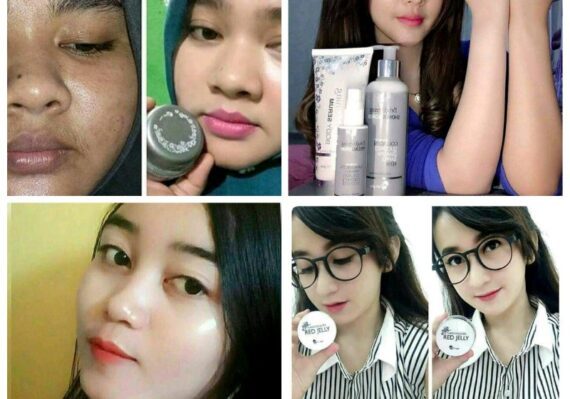 perawatan wajah di klinik ms glow_4aa1c6697.jpg